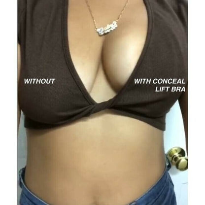 Lifting and shaping silicone breast stickers